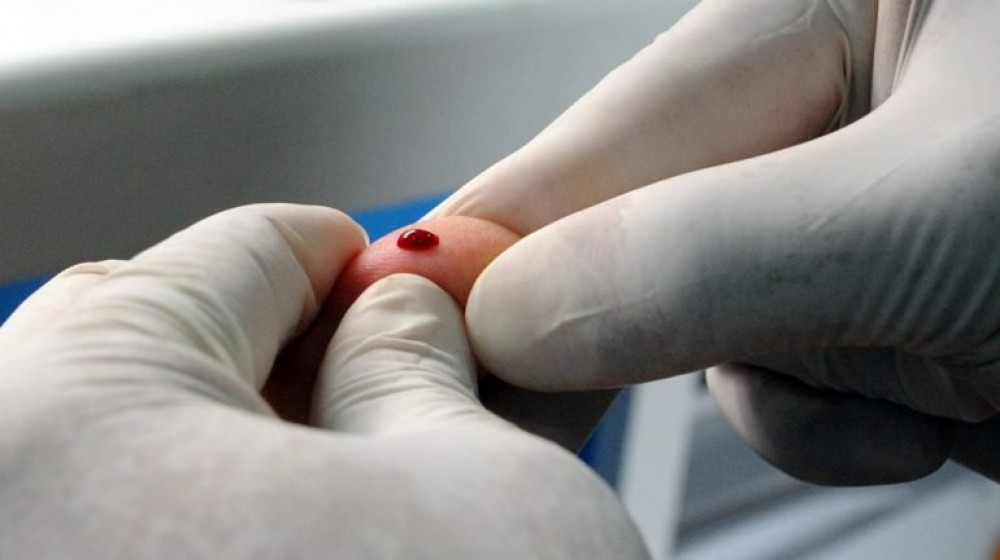 Testes de VIH e hepatites B e C vão poder ser feitos em farmácias